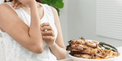 Food Allergen Awareness Training